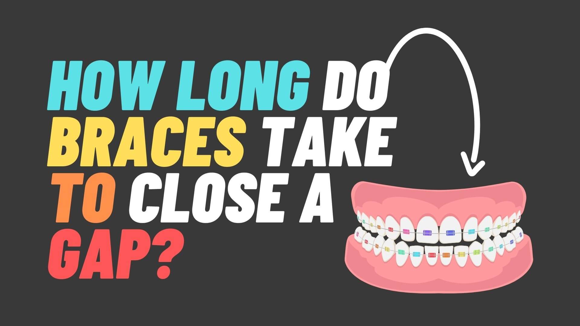 How Long Do Braces Take To Close a Gap?